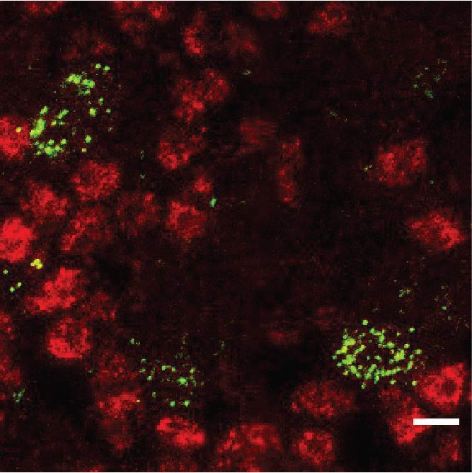 Thymus cells making AIRE (green) that educate the surrounding developing T cells (red) / WEHI