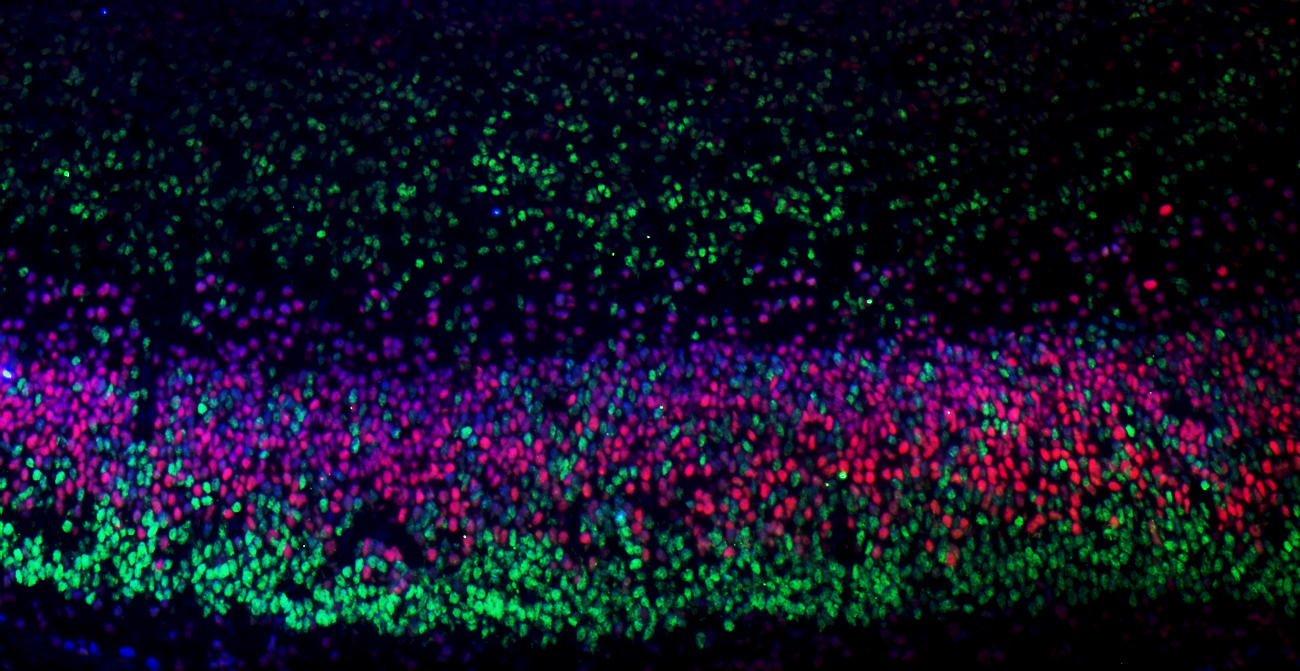 Cation: Distinct layers of the brain. Credit: WEHI