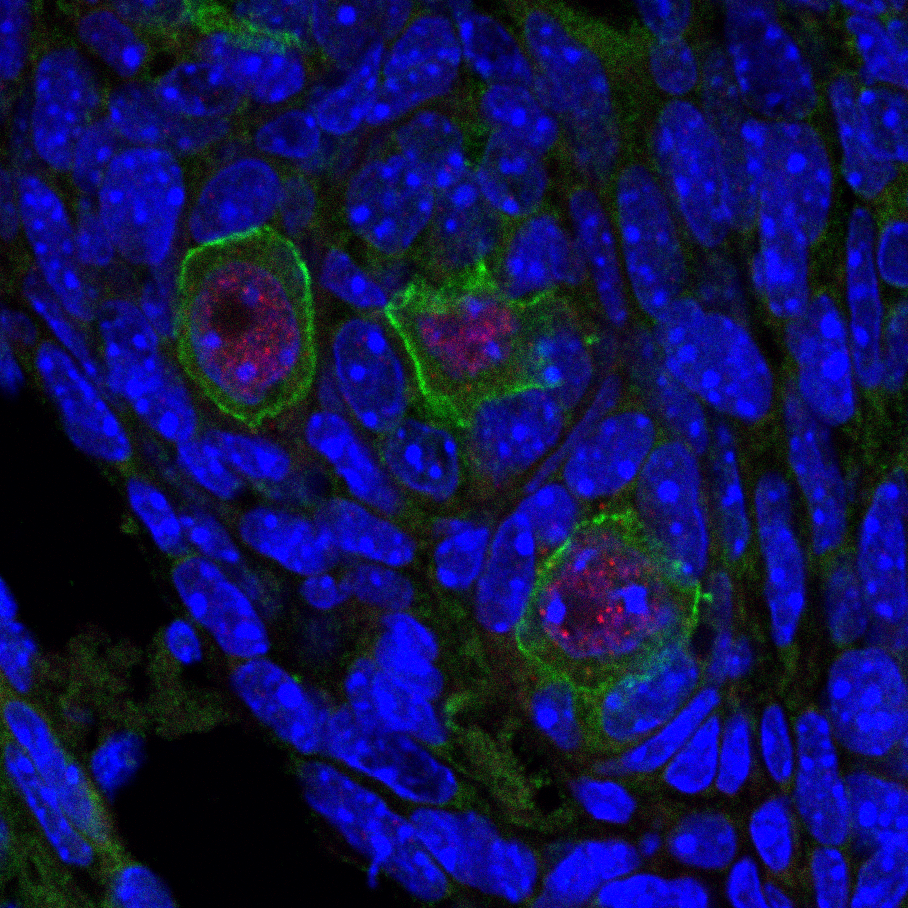 Ovarian tissue containing fluorescently-labelled oocytes (eggs; green) with a BRCA1 mutation, showing sites of DNA damage (red)