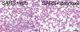 Covid-19-affected lung tissue: control (left) and idronoxil-treated (right)