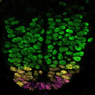 Developing mouse neural tube