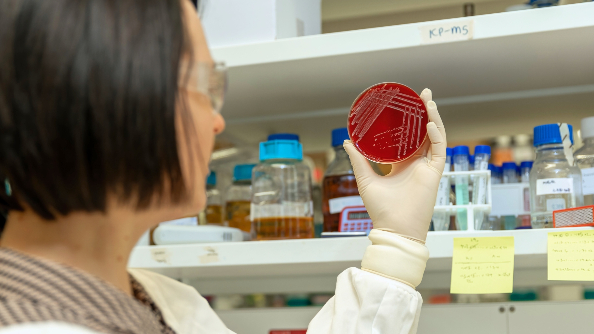Research Fellow Dr Stephanie Neville observing bacterial cultures in petri dish at the Doherty Institute (Credit: Cesar Nicolas/Doherty Institute)