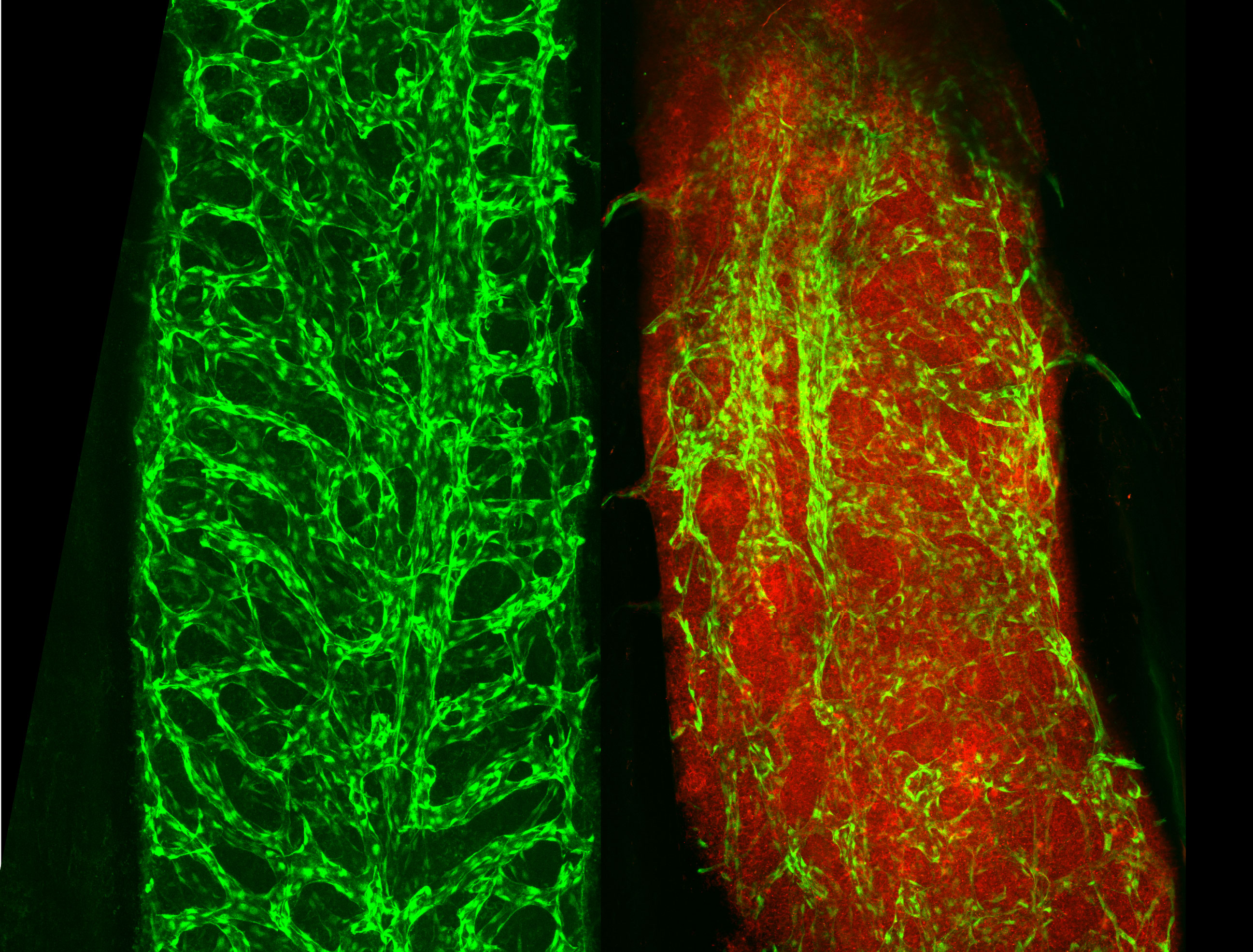 The image on the left shows blood vessels (pictured in green) in healthy bone marrow; the image on the right shows blood vessels in bone marrow that has AML (pictured in red). Credit: WEHI