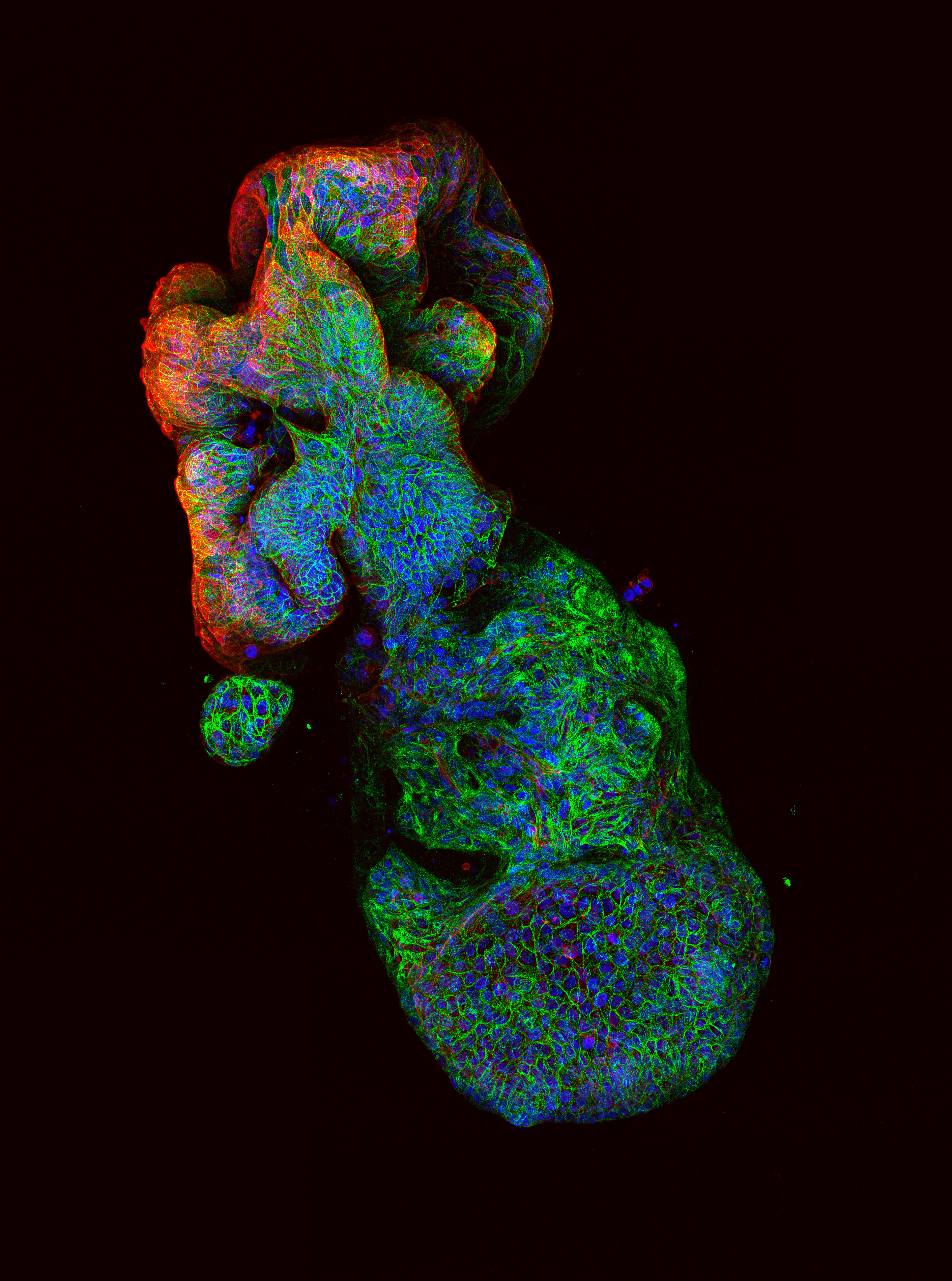 Pictured: A 3D structure of an organoid formed from human bowel cancer cells. Blue marks the nucleus of the individual cell, green is a protein that sticks each cell together and red shows the cancer cells’ orientation.   Credit: WEHI 