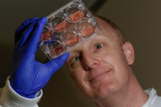 Dr Mark Pearson with the parasitic blood flukes Schistosoma haematobium