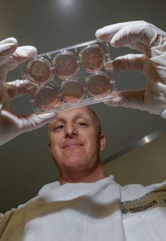 Dr Mark Pearson with the parasitic blood flukes Schistosoma haematobium 