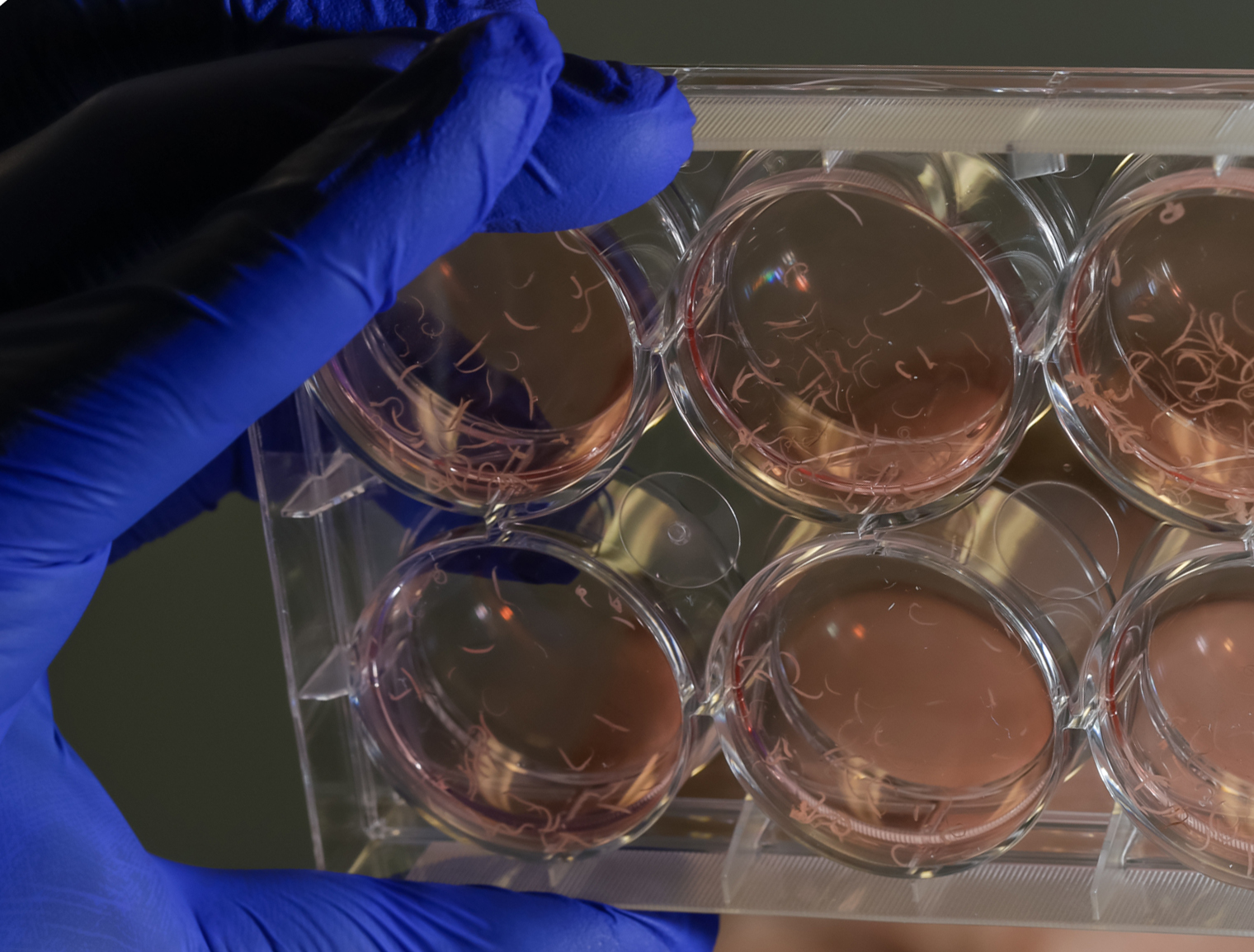 Schistosoma haematobium – ‘a tiny parasite that does a great deal of harm’. Photo: Romy Bullerjahn 