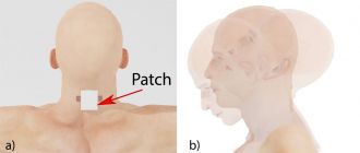 Concussion detector patch