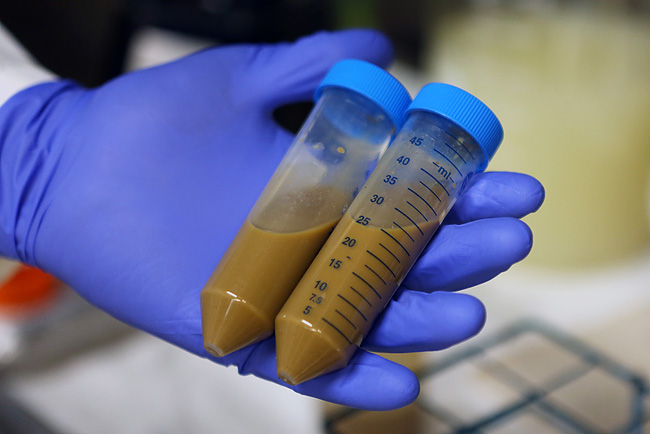 poo-transplants-image-credit-Minnesota-Public-Radio