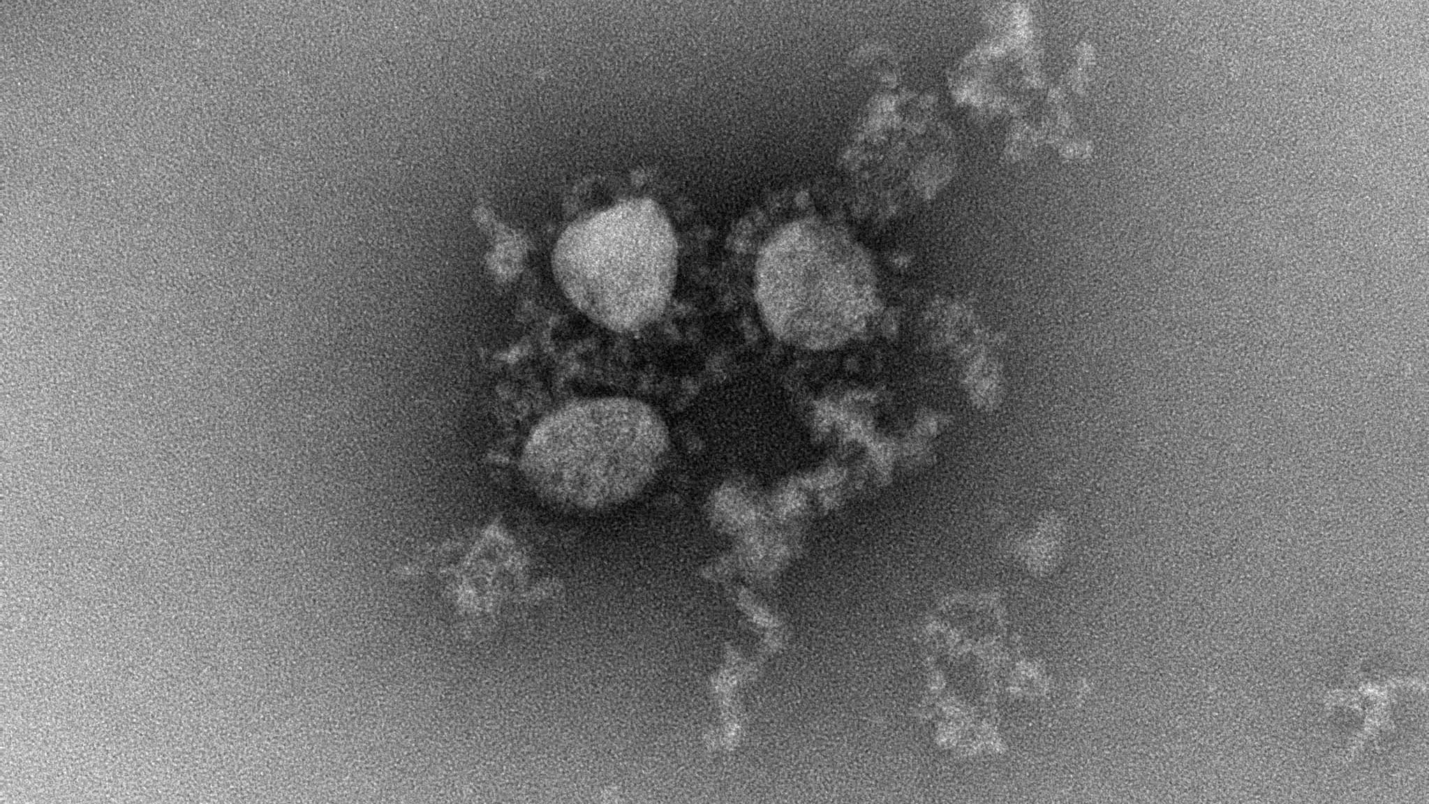 Dr Jason A. Roberts, Head, Electron Microscopy and Structural Virology, Doherty Institute