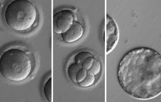 Embryo development