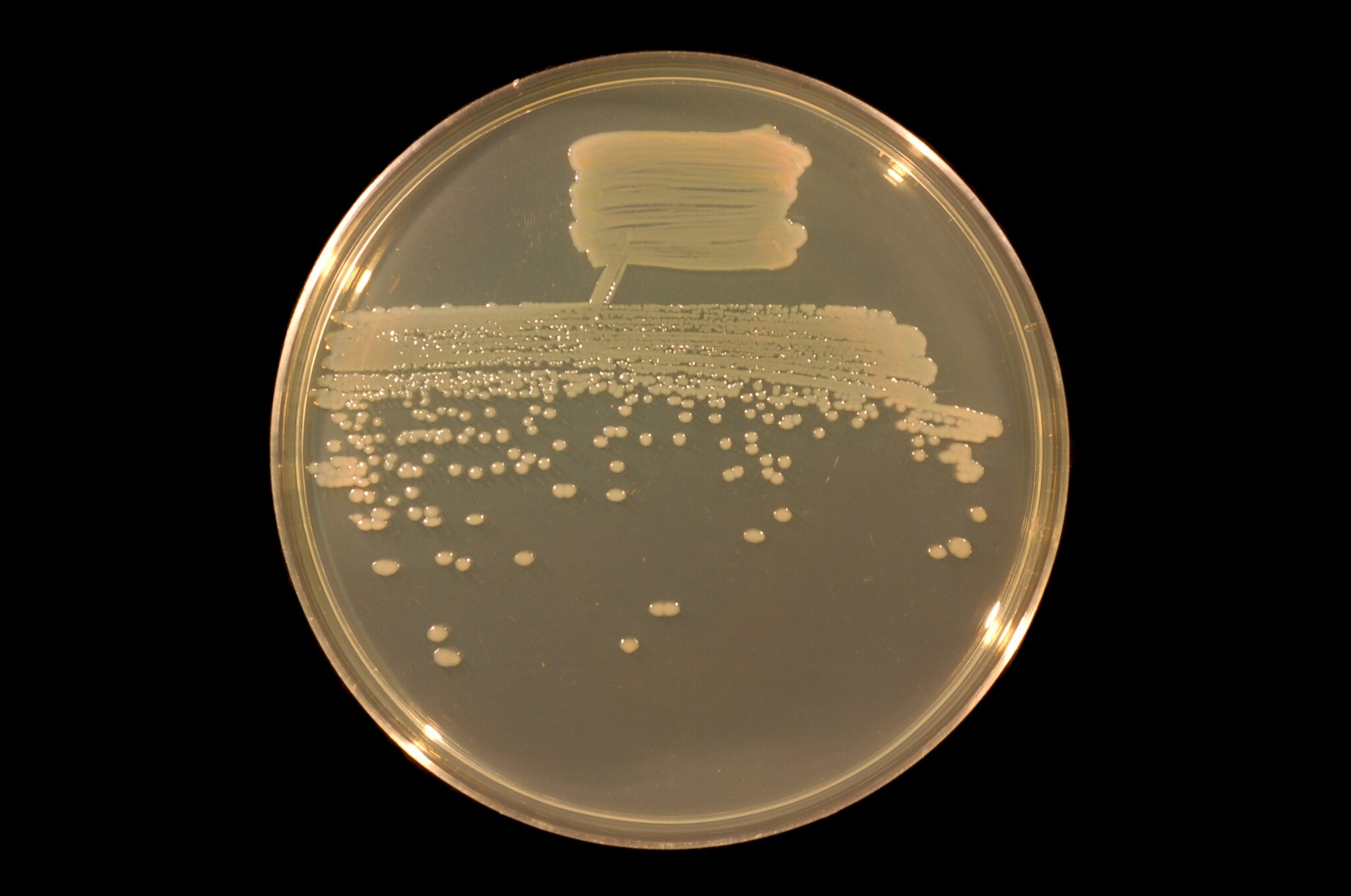 The bacterium Pseudomonas fluorescens streaked to single colonies on Tryptone-Yeast Extract (TY) agar and visualized under white light. Credit: Ninjatacoshell, CC BY-SA 3.0 <https://creativecommons.org/licenses/by-sa/3.0>, via Wikimedia Commons