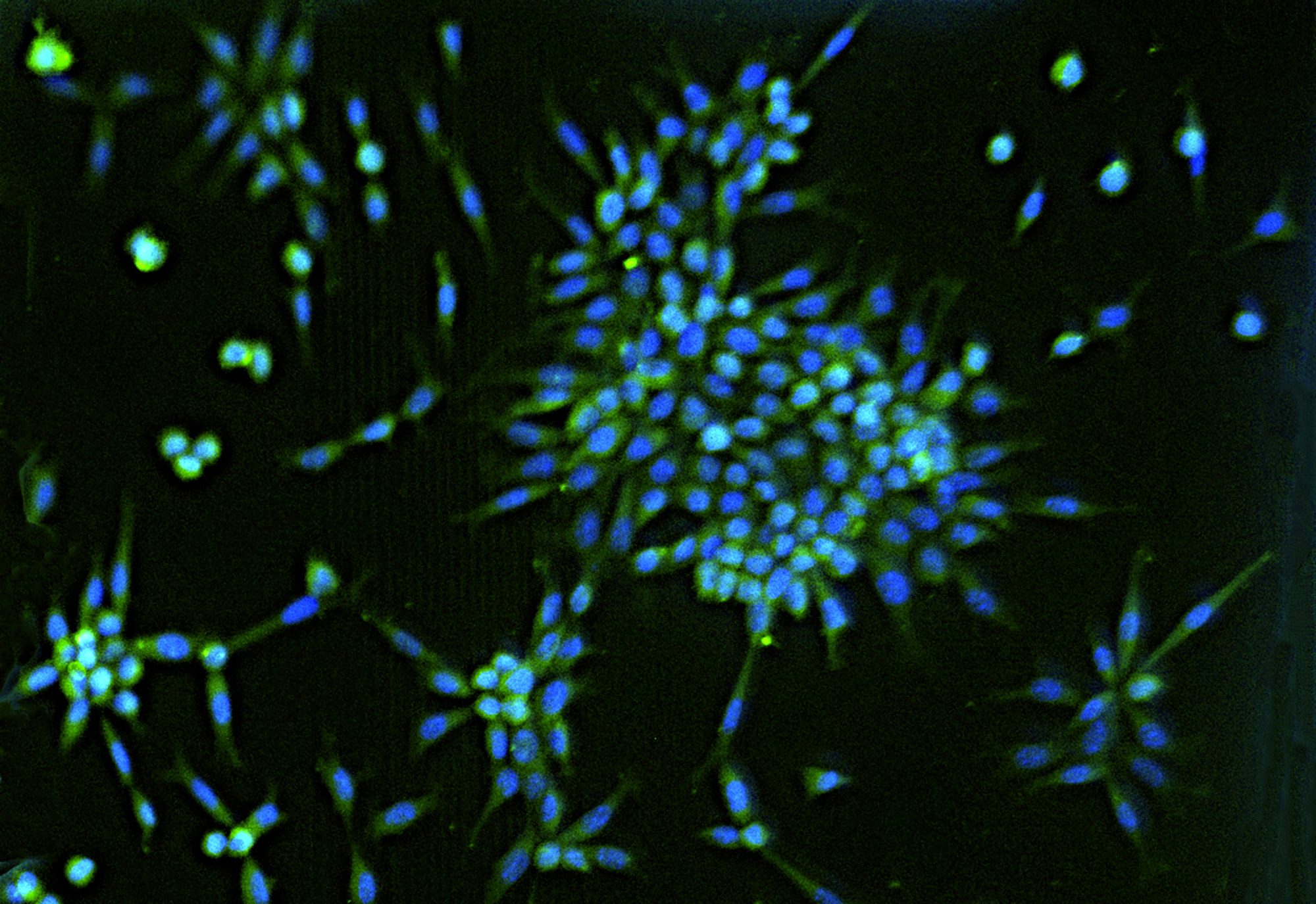 An image of cells on a disc-on-a-chip modelling a healthy intervertebral disc, researcher provided.