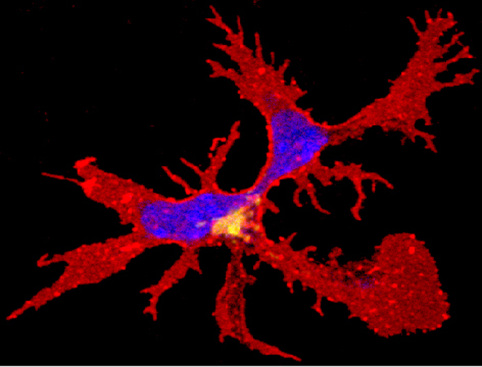 Dendritic cell. Credit: WEHI