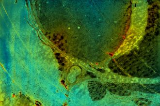 Section of optic nerve taken from a transgenic mouse