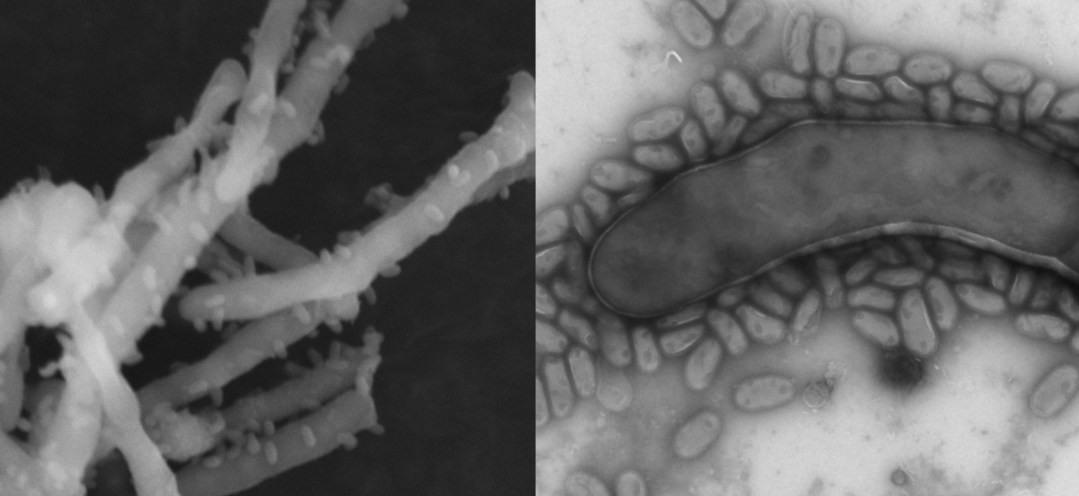 Ultrasmall parasitic bacteria (Mycosynbacter amalyticus) attach to the larger wastewater foaming bacterial cells (Gordonia pseudoamarae) leading to cell lysis. Imaged under scanning electron microscope. 