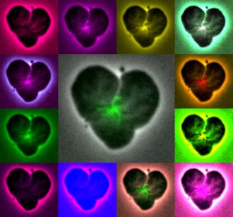 FtsZ: At the heart of cell division