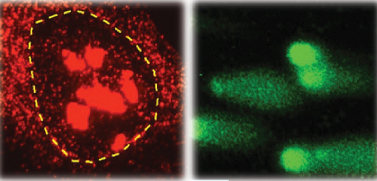 L-R Microscopic images showing bright red spots on a cell, indicating an increase in detrimental RNA:DNA Hybrids. Green image shows cells with high DNA damage forming a ‘comet’ shape, where the distinct tail contains fragmented DNA.  