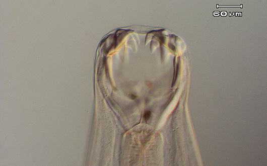 A hookworm viewed under the microscope. Image: Lyn Knott