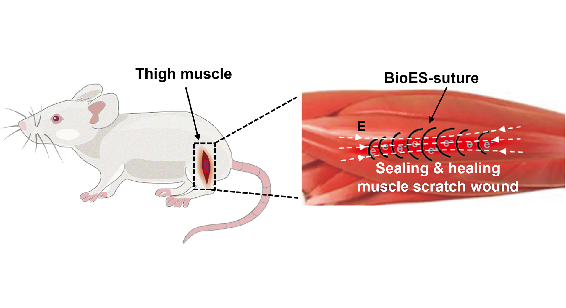 An illustration of wound sealing and healing functions offered by the bioabsorbable electrical stimulation suture (BioES-suture) Credit: Zhouquan Sun and Chengyi Hou