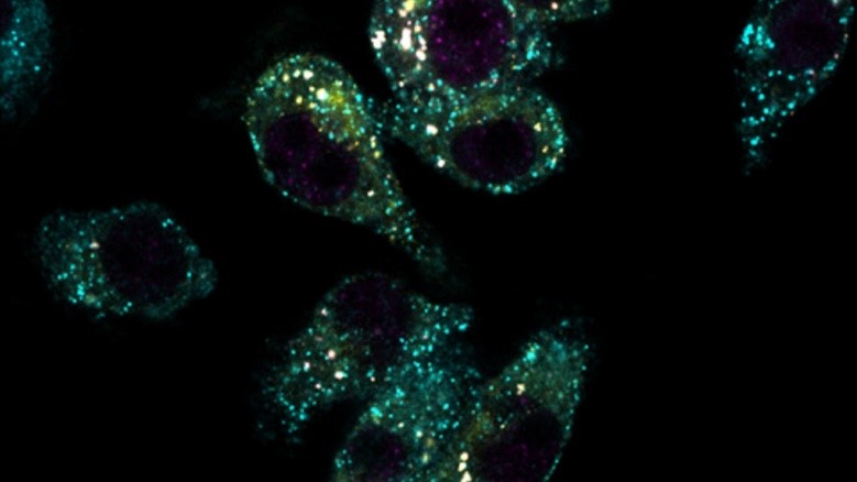Microscopy of fluorescent STING (eGFP-STING, in yellow) co-localising with ESCRT protein HRS shown in cyan and ubiquitin shown in magenta. These interactions were found to be involved in STING transport to the lysosome, the rubbish disposal system of the cell, for its degradation. Image credit: Dr Kate Balka