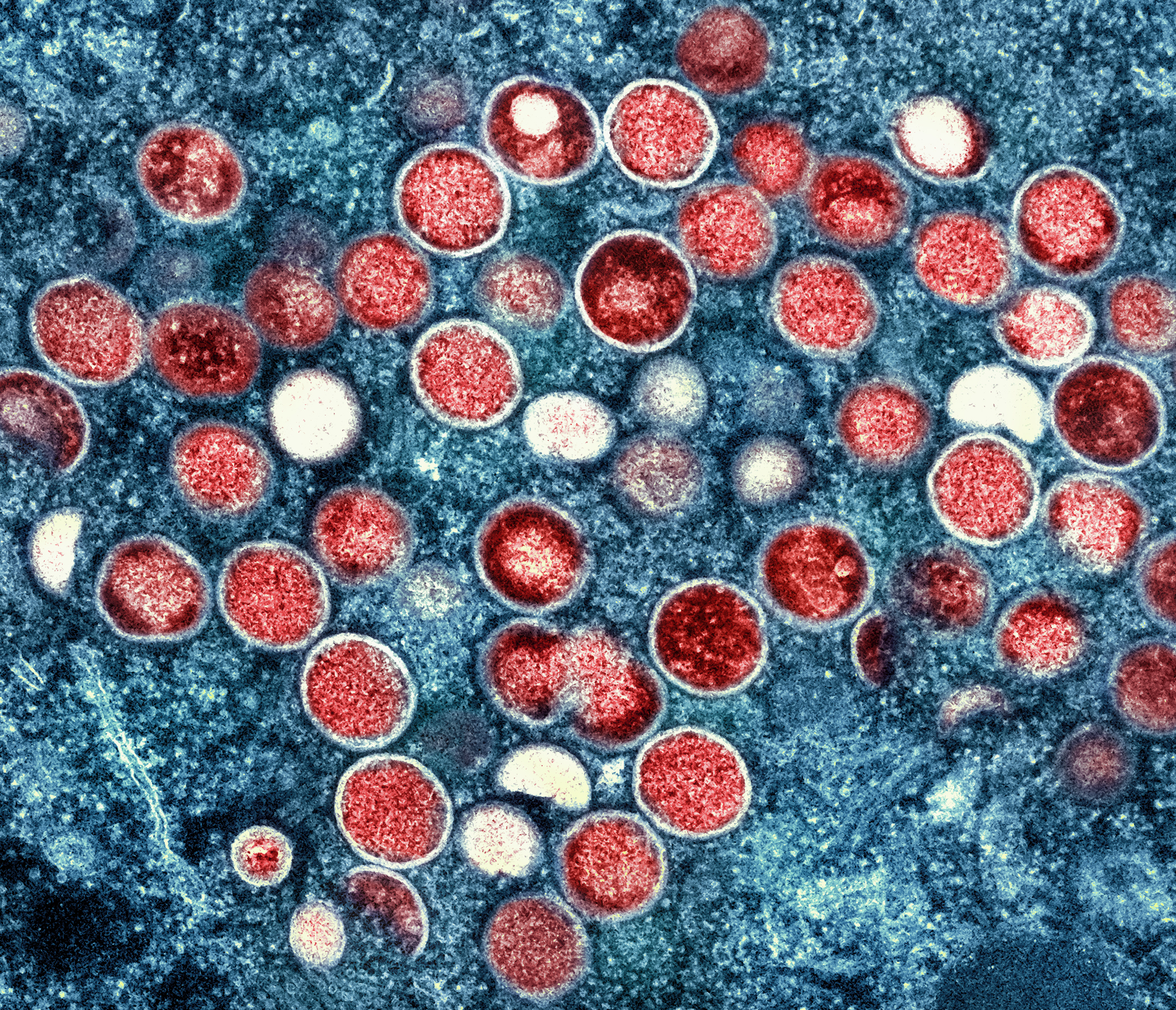 NIAID, CC BY 2.0 <https://creativecommons.org/licenses/by/2.0>, via Wikimedia Commons