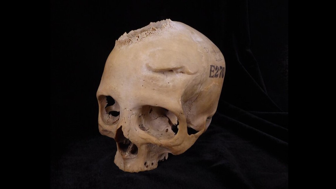 Skull E720: Skull E270, dating from between 663 and 343 BCE, belonged to a female individual who was older than 50 years. Image: Tondini, Isidro, Camarós, 2024.