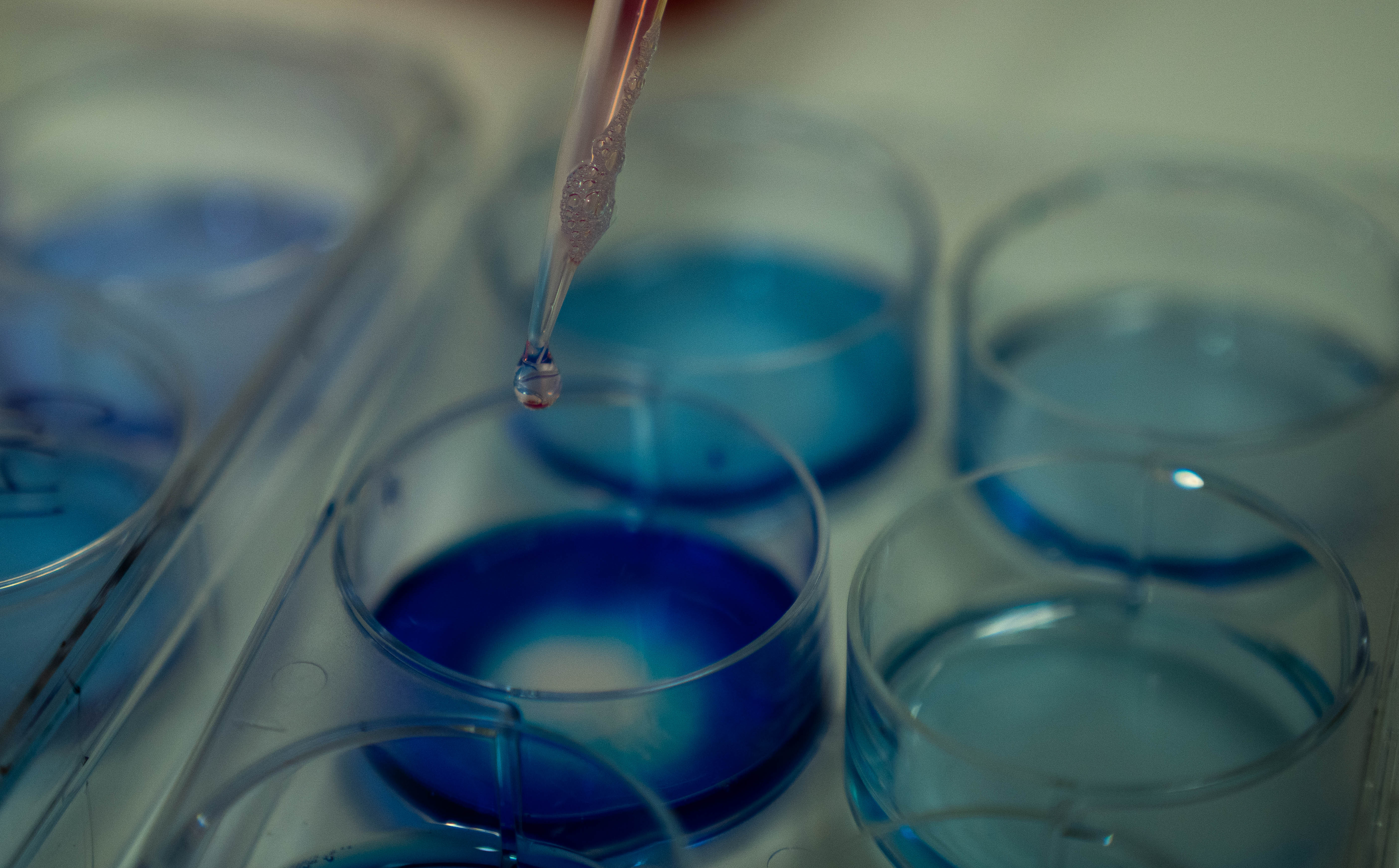 The findings could lead to new and tailored treatments for Sjogren’s Syndrome and lupus that is caused by TNIP1 variants.  Photo: Tracey Nearmy/ANU