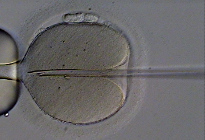A human oocyte is held by a glass holding pipette (left). A beveled glass pipette containing an immobilized ejaculated spermatozoon is inserted through the zona pellucida and deep into the oolemma, creating a deep furrow. Once the membrane of the oocyte is penetrated, the sperm is deposited therein. Photo credit: Eugene Ermolovich (CRMI)/Wikipedia Commons