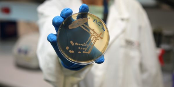 Microbial research in the lab. Photo: Hudson Institute of Medical Research