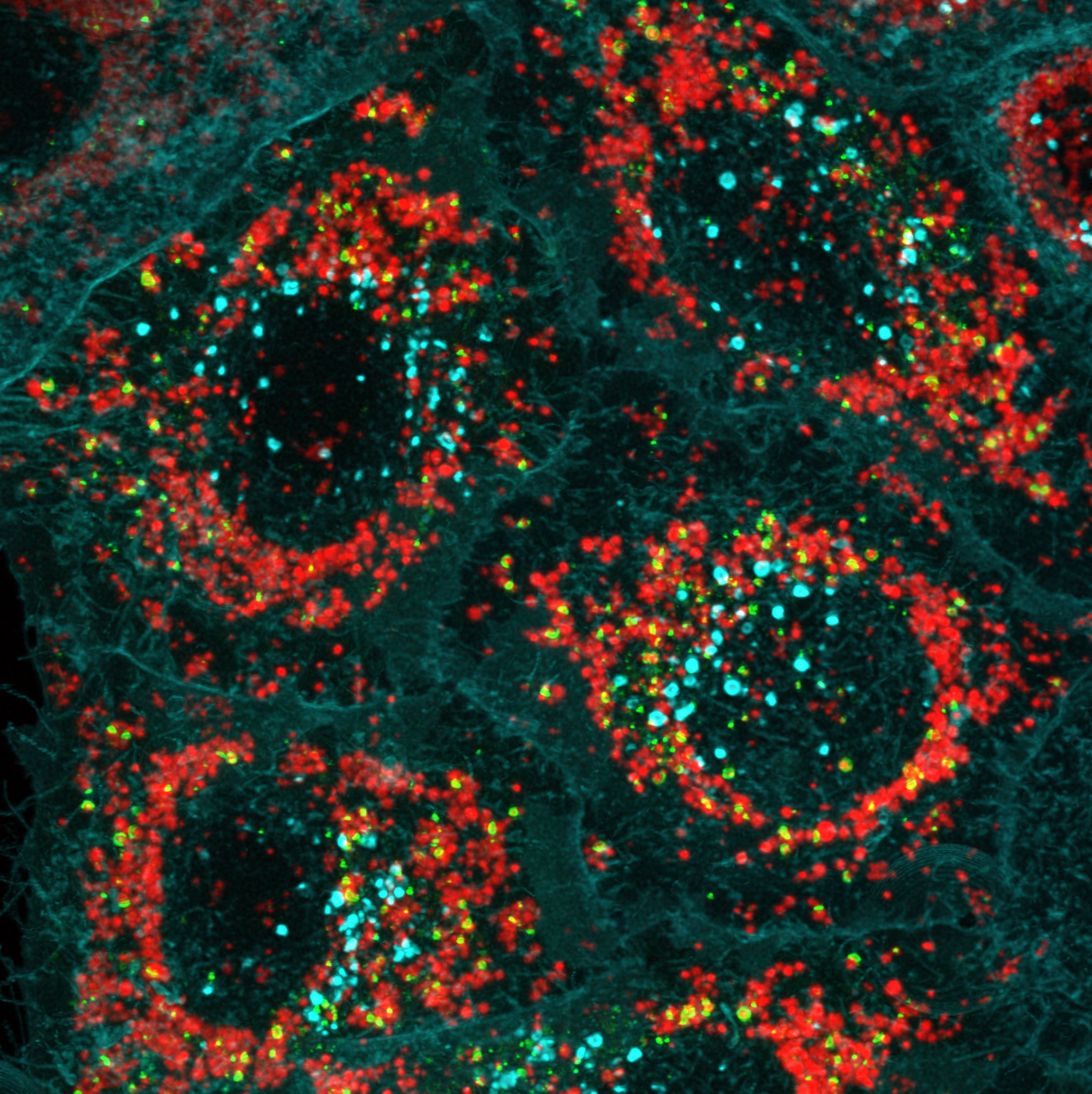 Cellular ‘garbage bags’ being built through Optineurin (green), around damaged mitochondria (red).  Credit: WEHI