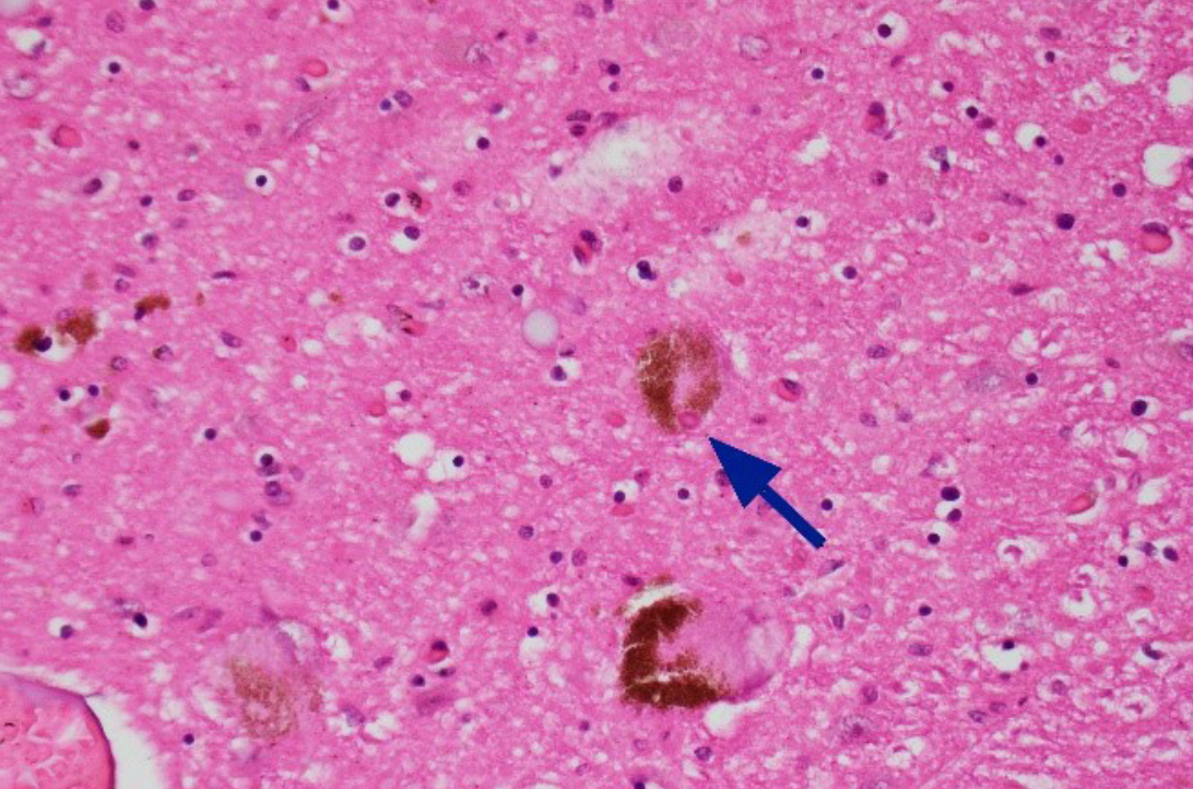 Image from the paper (c)