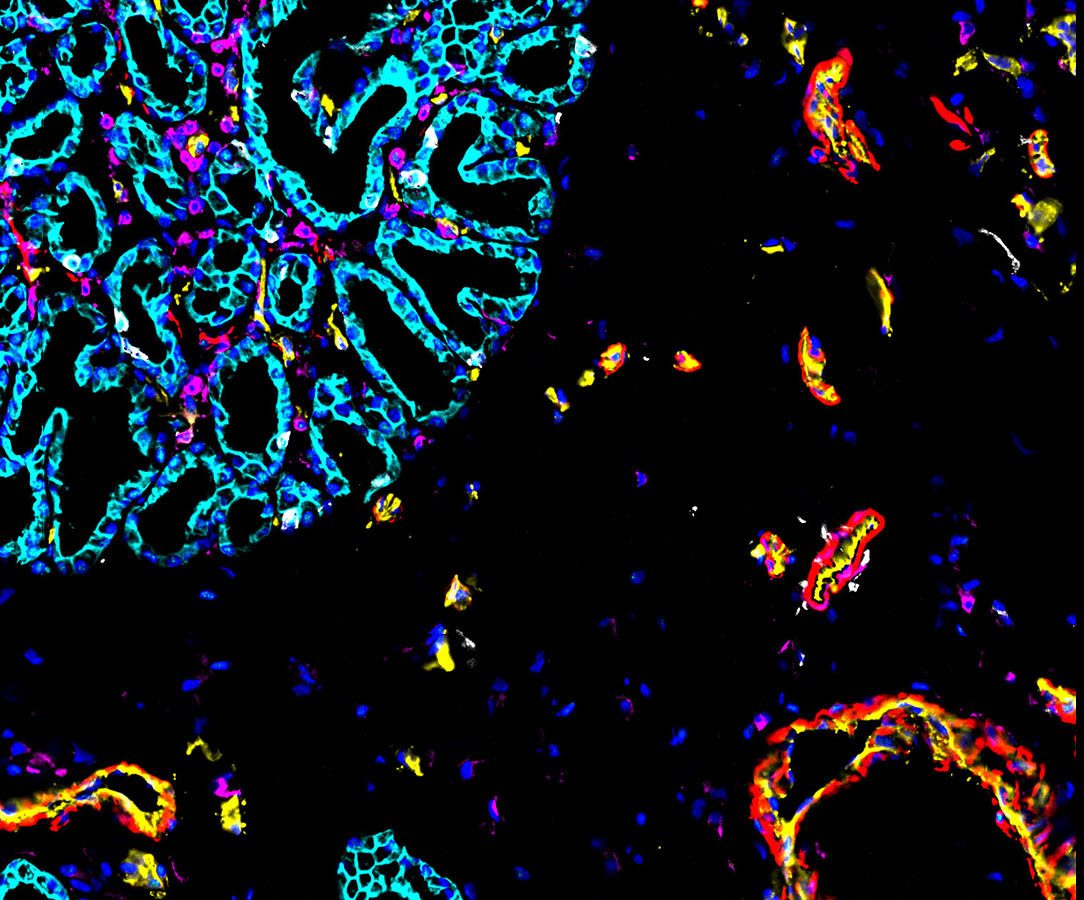 The Human BioMolecular Atlas Program: A CODEX image of intestines, courtesy of Dr. John Hickey at Stanford’s Garry Nolan Lab.