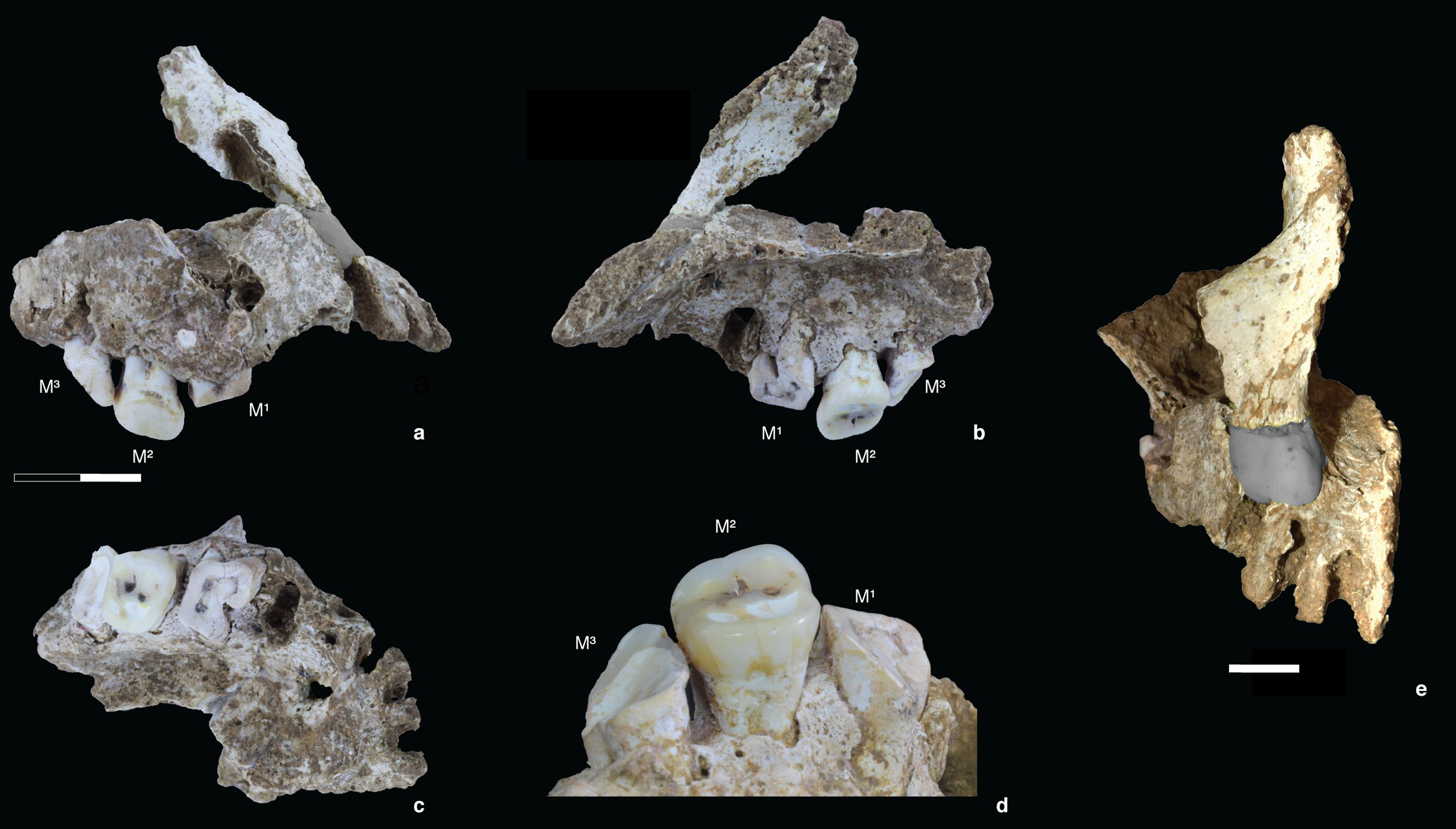 Fig 6. Right maxilla and frontal process (Maros-LBB-1a) from Layer 4a at Leang Bulu Bettue. (a-b) right and left lateral views of the right maxilla (after reconstruction). The small point of contact between the dental portion and nasal pillar is obscured by glue and plasticine; (c) inferior view of the right palate; (d) detail of the lingual sides of the extant first to third right upper molars (M1 toM3), showing the extreme degree of occlusal attrition on theM1 andM3. TheM1 had lost its crown by extreme wear and there are abscess cavities around the root tips, owing to the exposure of dental pulp cavities. TheM3 retains its enamel only at the mesiobuccal corner. Only theM2 has a normal occlusal plane. TheM2 still retains much of its occlusal enamel but is considerably over-erupted, suggesting that its opposing tooth (M2) had been lost while the individual was alive; (e) anterior view of the reconstruction of the right maxilla and frontal process. The scale in (a-c) is in 10 mm increments; in (e) the scale bar is 10 mm. Photo credits: Ratno Sardi (a-d); David Bulbeck (e).