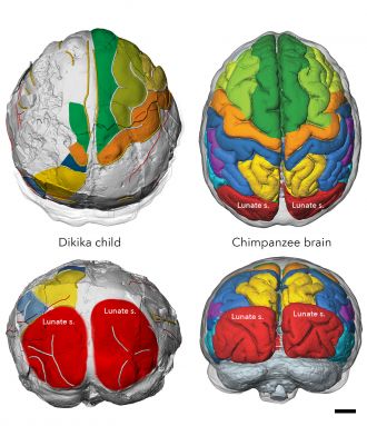 Dikka child vs Chimpanzee brain