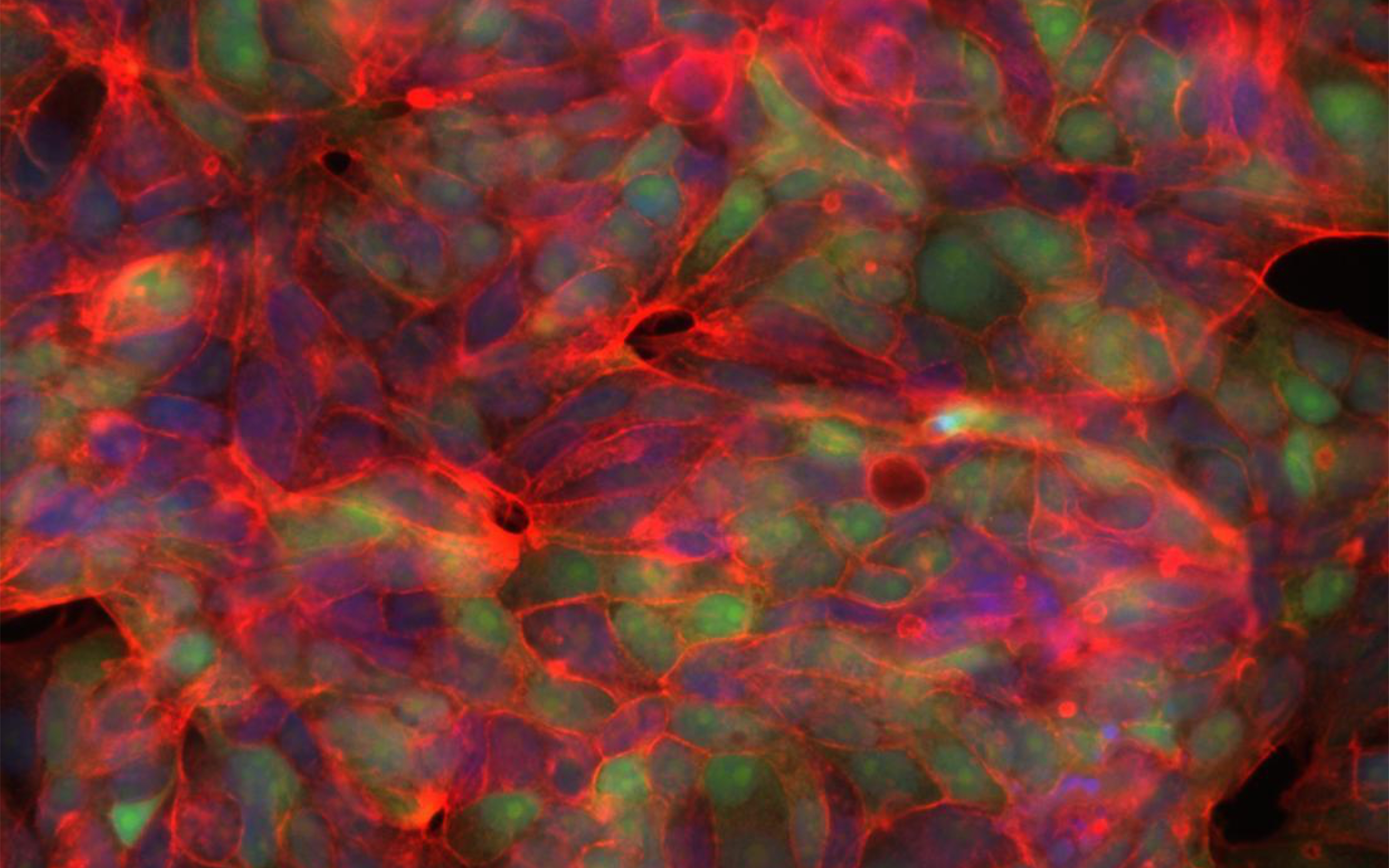 Senescent cancer cells. Credit: University of Melbourne