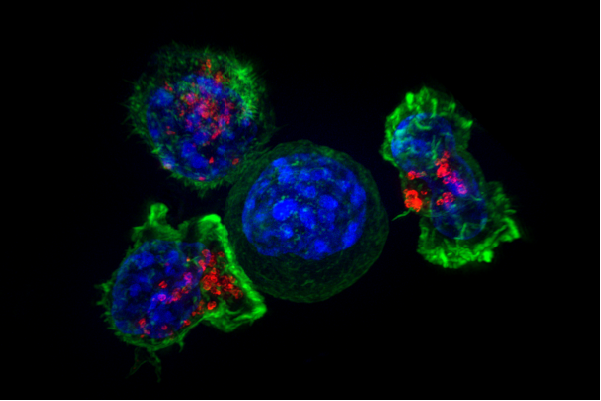 Killer T cells surround a cancer cell (not from this study) - NIH Image Gallery