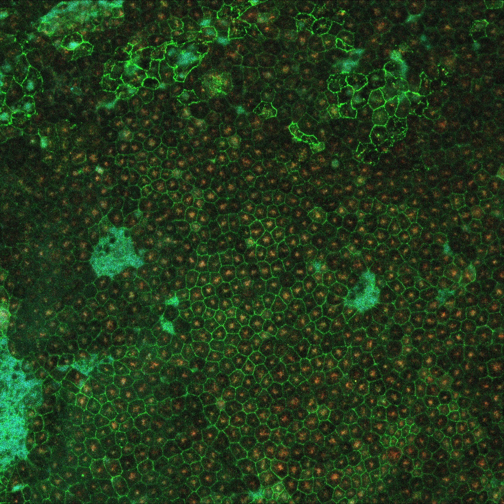 Fluorescent imaging of retinal pigment epithelium. Credit: Dr Grace Lidgerwood