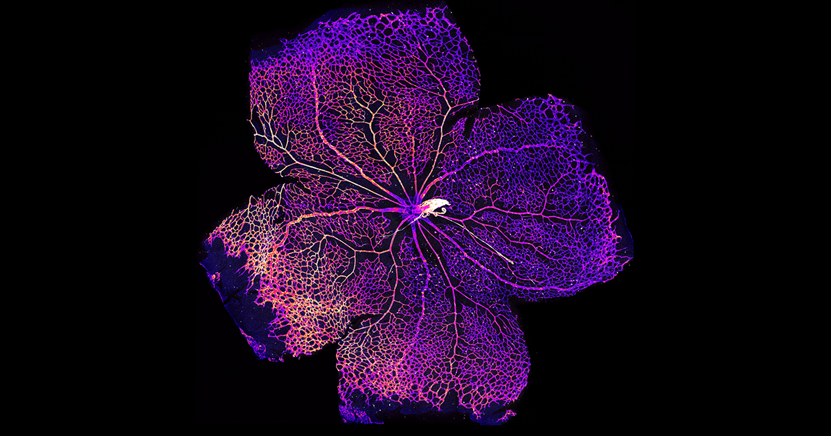 Caption for image: WEHI researchers identified genetic differences in MacTel patients that affect the structure of blood vessels in the retina (pictured), and the production and delivery of critical amino acids to this tissue. Image courtesy of WEHI. 
