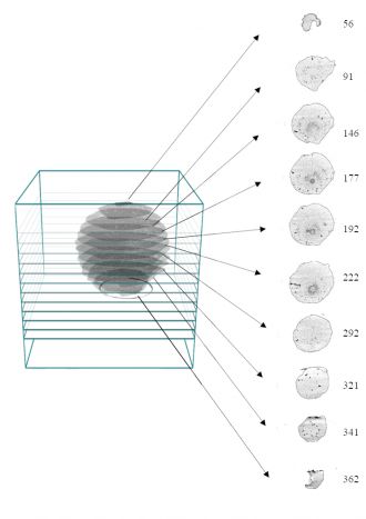 : Illustration exemplifying the CTS analysis method. 