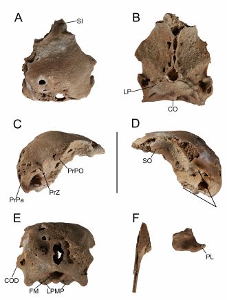 Neurocranium