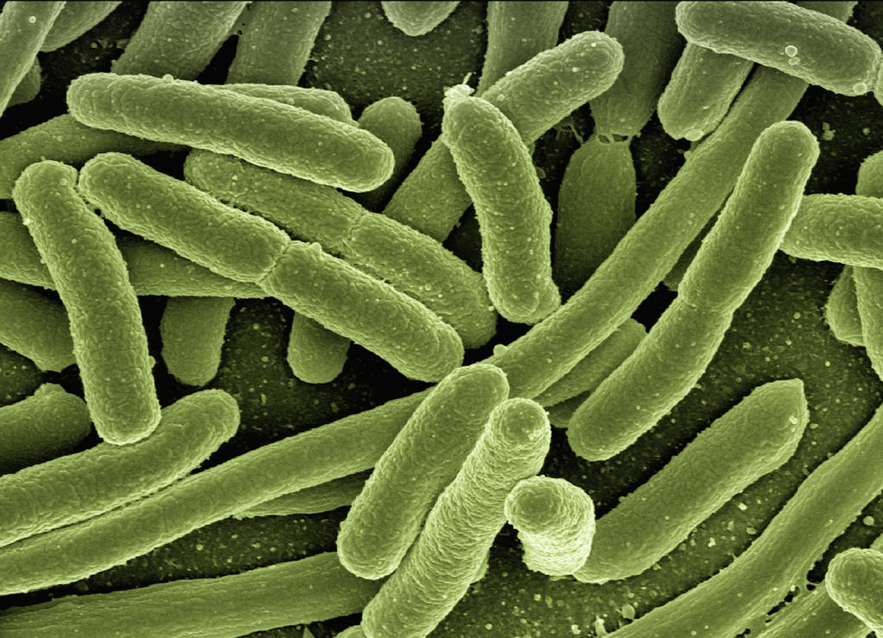 CC-0. https://pixabay.com/photos/koli-bacteria-escherichia-coli-123081/