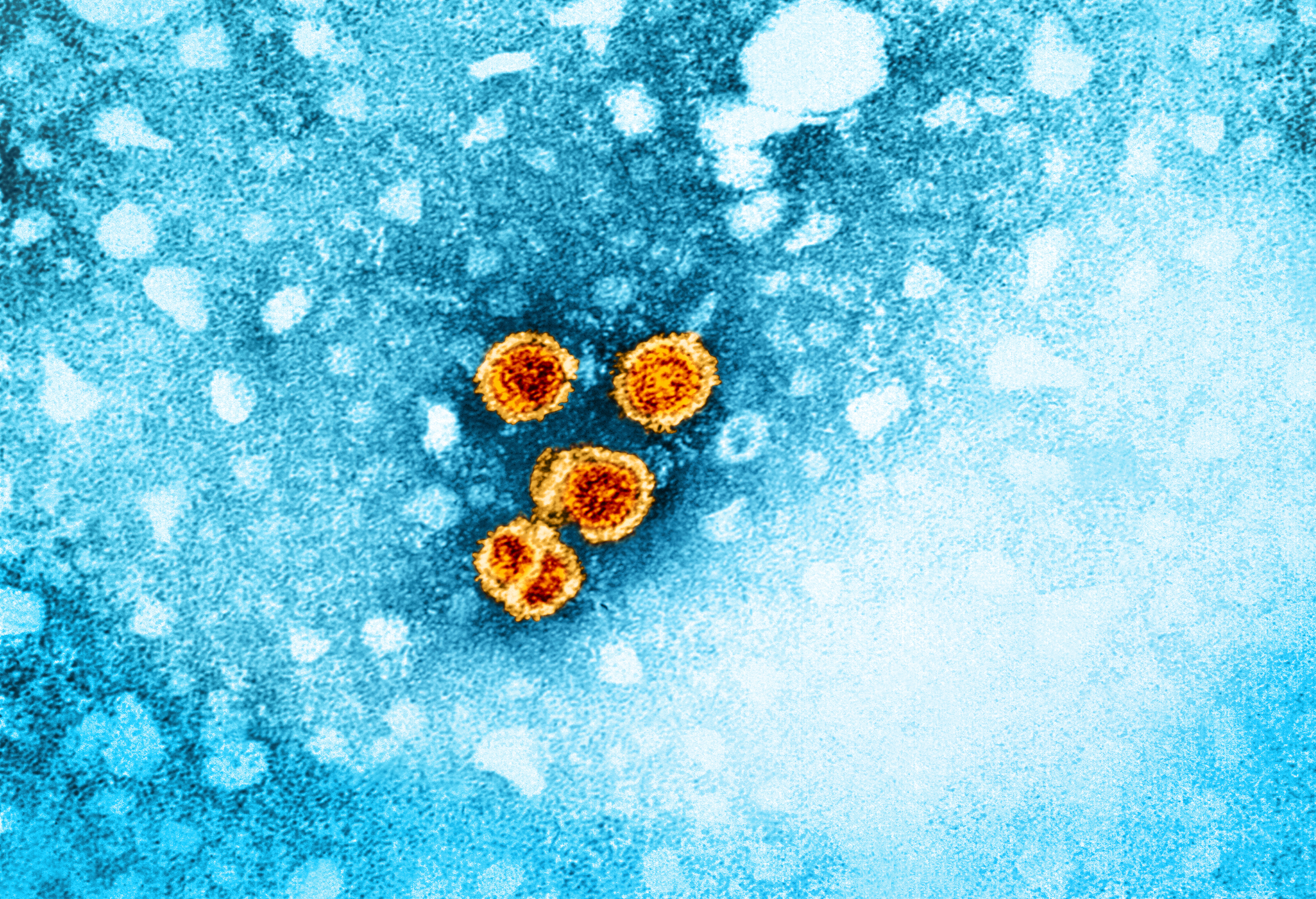 NIAID, CC BY 2.0 <https://creativecommons.org/licenses/by/2.0>, via Wikimedia Commons