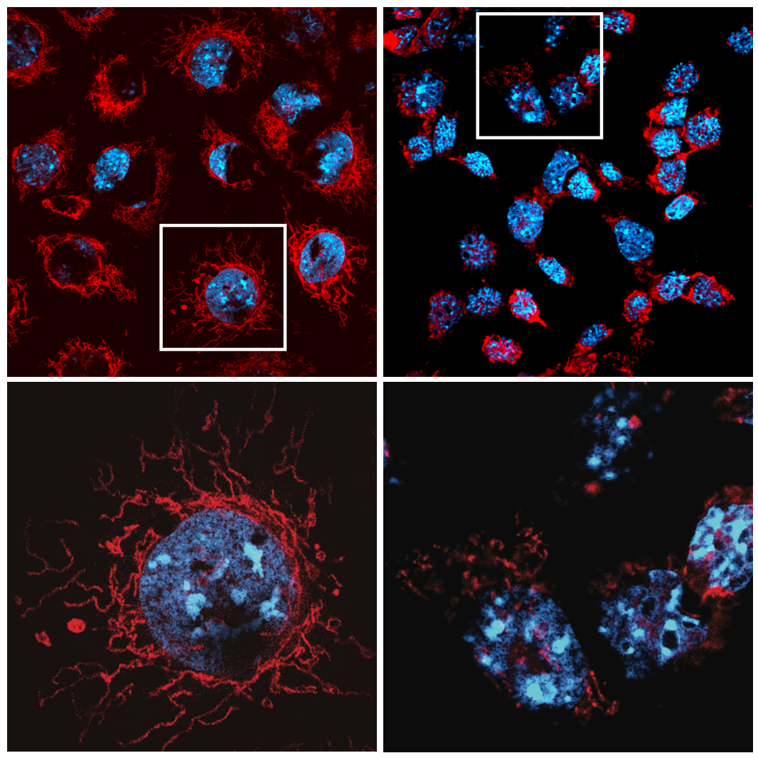 Loss of MCL-1 triggers severe mitochondrial damage (shown in the right panel). Mitochondria are shown in red, cell nuclei in blue. Credit: WEHI