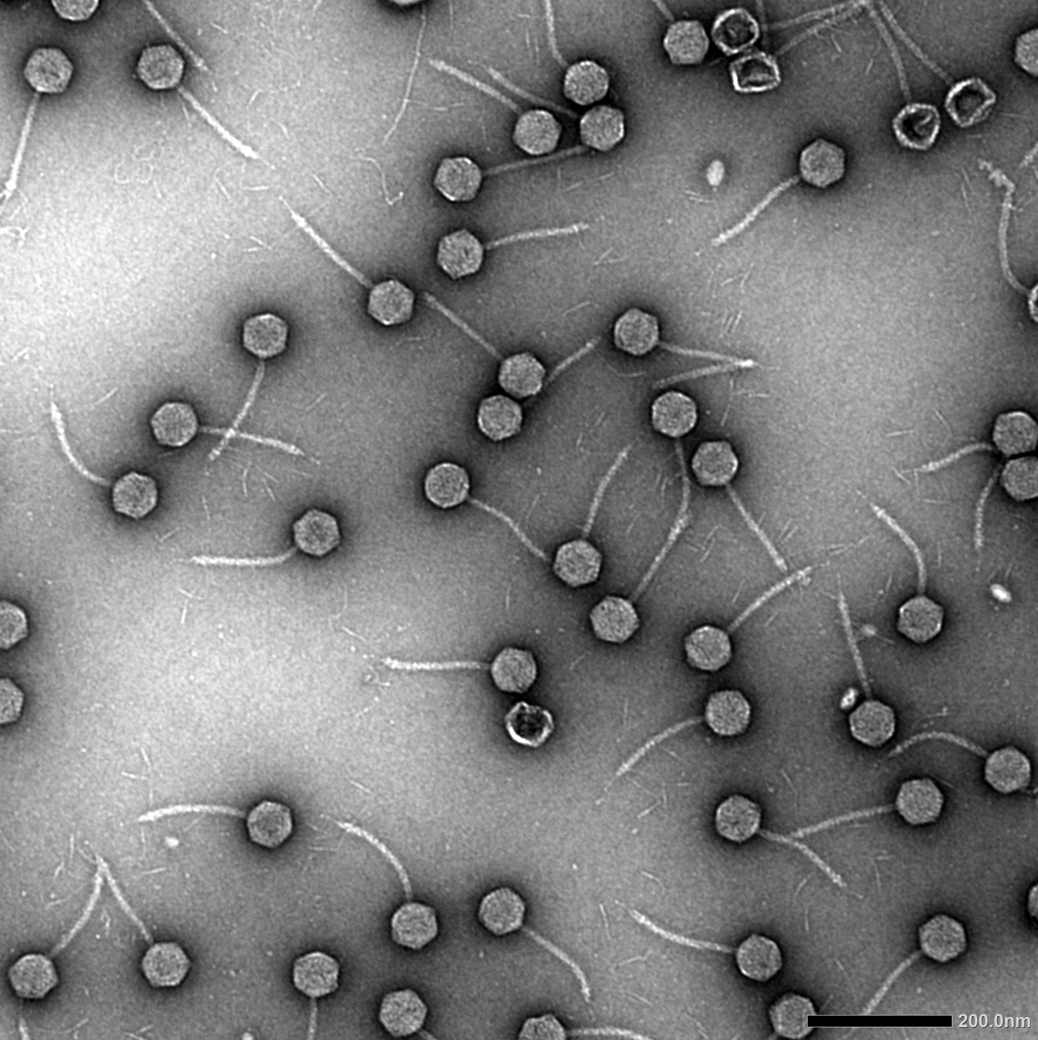 Telomere phages from Klebsiella, viewed by transmission electron microscopy. Photo credit: Dr Yan Li, Lithgow lab who acknowledges the Monash Ramaciotti Centre for Cryo-Electron Microscopy. The black scale bar is 200 nm long.	