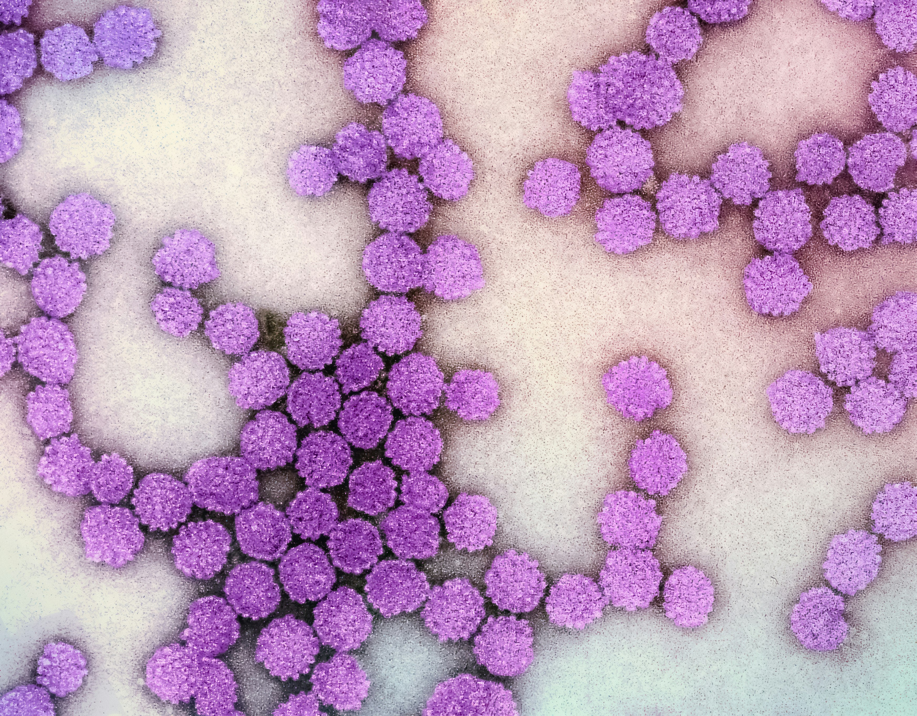 Human Papillomavirus (HPV) Colorized electron micrograph by  National Institute of Allergy and Infectious Diseases via UnSplash
