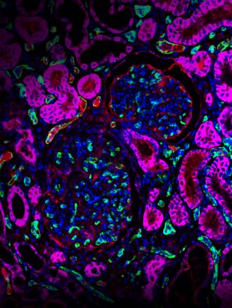 CRISPR Kidney Supported Life in the NHP for 758 Days