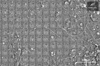 Dendric network: brain cells cultured on a multi-electrode array