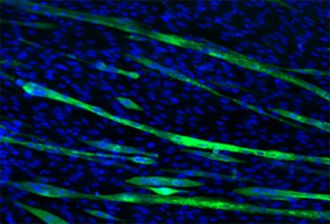 Visualization of green-colored myotubes