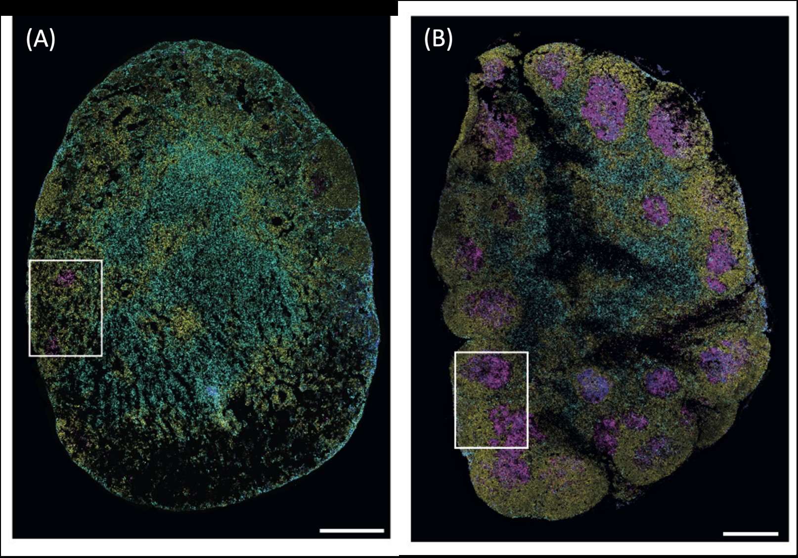 Immunofluorescence images showing a chronically helminth infected lymph node (A) or resistant lymph node (B) © 2023 The Authors. Published by Elsevier Inc. on behalf of Society for Mucosal Immunology.